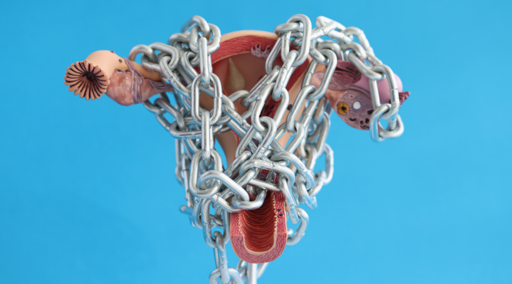All About Adenomyosis