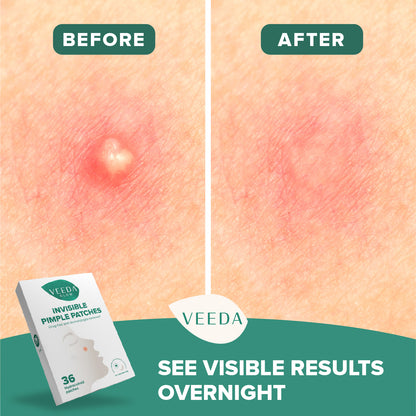 Veeda Glow Invisible Hydrocolloid Pimple Patches